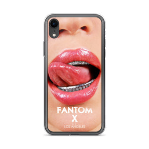 FX Diamond Grill iPhone Case